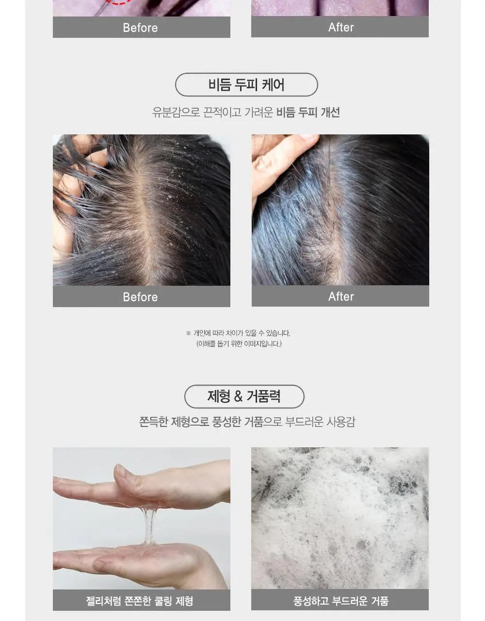 [텅장구조_탈모샴푸] 포레스트스토리 B7 안티 헤어 로스 쿨샴푸 200ml 상세페이지 11